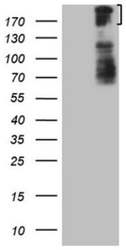 BCOR Antibody (OTI4F6), Novus Biologicals 0.1mL; Unlabeled:Antibodies,