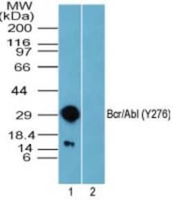 BCR, p Tyr276 Antibody, Novus Biologicals 0.02mg; Unlabeled:Antibodies,