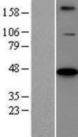 Novus Biologicals&trade;&nbsp;BCS1L Overexpression Lysate