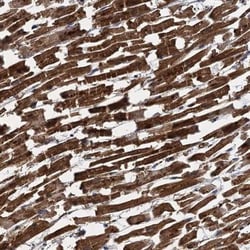 BCS1L Antibody, Novus Biologicals:Antibodies:Primary Antibodies