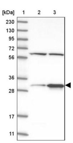 BDH1 Antibody, Novus Biologicals 0.1mL; Unlabeled:Antibodies