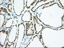 BDH2 Antibody (OTI2G1), Novus Biologicals 0.1mL; Unlabeled:Antibodies,