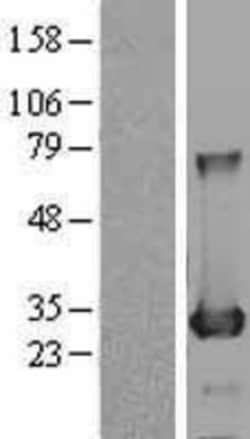 Novus Biologicals™ BDH2 Overexpression Lysate