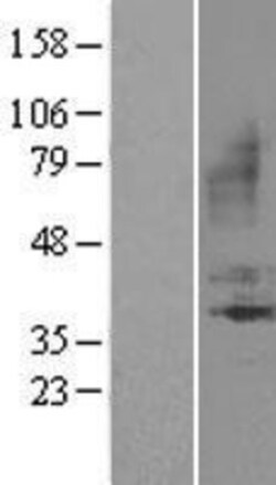 Novus Biologicals™ Bradykinin RB1/BDKRB1 Overexpression Lysate