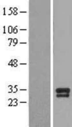 Novus Biologicals™ BDNF Overexpression Lysate