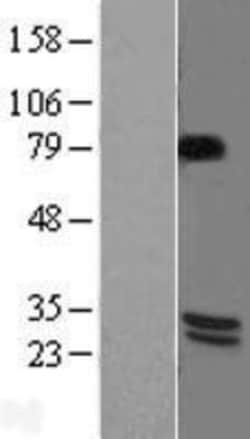 Novus Biologicals&trade;&nbsp;BDNF Overexpression Lysate