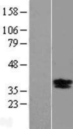 Novus Biologicals&trade;&nbsp;BDNF Overexpression Lysate