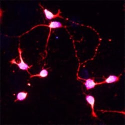 BDNF Antibody, Novus Biologicals 0.1mL; Unlabeled:Antibodies, Polyclonal