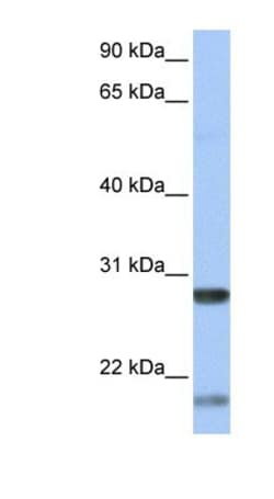 BDNF Antibody, Novus Biologicals 0.05mg; Unlabeled:Antibodies, Polyclonal