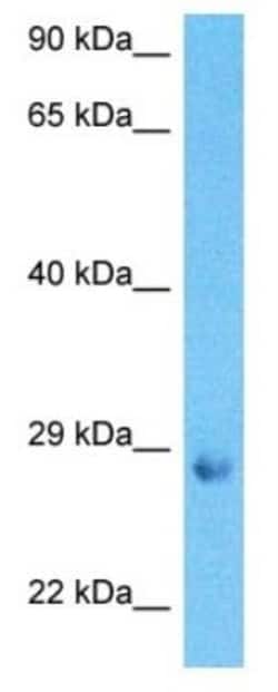 BDNF Antibody, Novus Biologicals 0.05mg; Unlabeled:Antibodies, Polyclonal