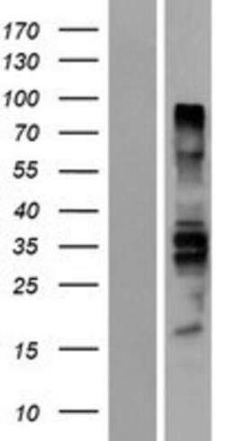 Novus Biologicals&trade;&nbsp;BDP1 Overexpression Lysate