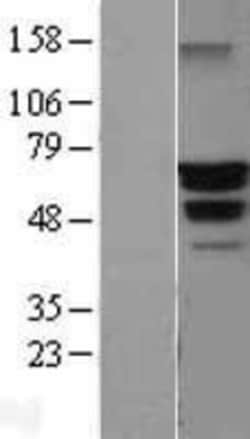 Novus Biologicals&trade;&nbsp;Beclin 1 Overexpression Lysate
