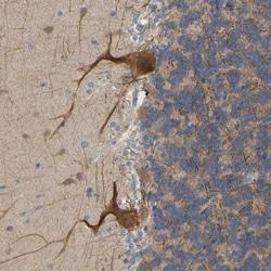 BEND3 Antibody, Novus Biologicals:Antibodies:Primary Antibodies