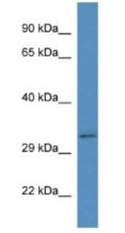 Bend6 Antibody, Novus Biologicals 100&mu;L; Unlabeled:Antibodies, Polyclonal