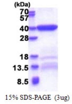 Novus Biologicals&trade;&nbsp;Recombinant Human Bend6 His Protein