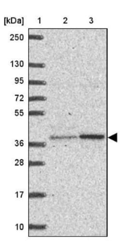 BEN Domain Containing 5 Antibody, Novus Biologicals 25 &mu;L, Unlabeled:Antibodies,