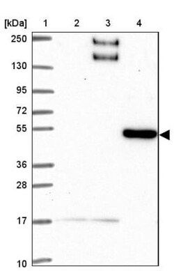 BEN Domain Containing 5 Antibody, Novus Biologicals 25 &mu;L, Unlabeled:Antibodies,