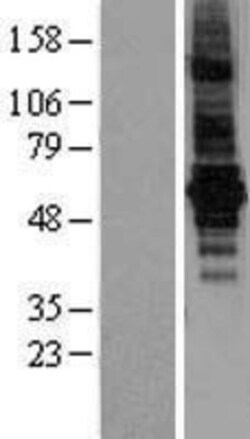 Novus Biologicals&trade;&nbsp;Bestrophin 2 Overexpression Lysate
