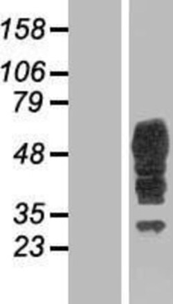 Novus Biologicals&trade;&nbsp;Bestrophin 3 Overexpression Lysate