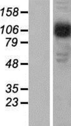 Novus Biologicals&trade;&nbsp;Beta 2 Adaptin Overexpression Lysate
