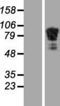 Novus Biologicals™ beta Adducin Overexpression Lysate