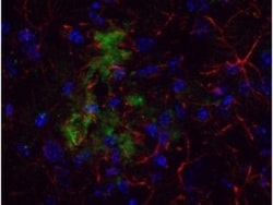 beta Amyloid Antibody, Novus Biologicals 0.1mg; Unlabeled:Antibodies, Polyclonal