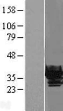 Novus Biologicals&trade;&nbsp;beta B1 Crystallin Overexpression Lysate