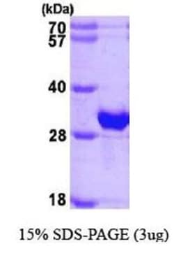 Novus Biologicals&trade;&nbsp;Recombinant Human beta B1 Crystallin His Protein