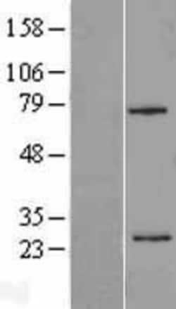 Novus Biologicals&trade;&nbsp;beta Casein Overexpression Lysate