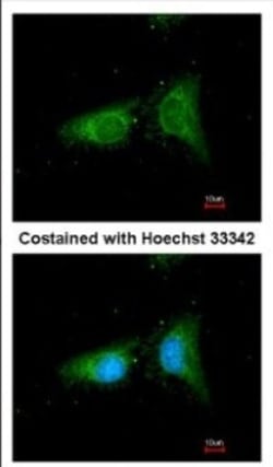 beta COP Antibody, Novus Biologicals 0.1mL; Unlabeled:Antibodies, Polyclonal