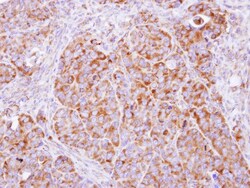 beta COP Antibody, Novus Biologicals 0.1mL; Unlabeled:Antibodies, Polyclonal