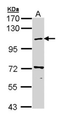 beta COP Antibody, Novus Biologicals 0.1mL; Unlabeled:Antibodies, Polyclonal