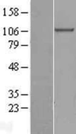 Novus Biologicals beta COP Overexpression Lysate 0.1mg:Protein Analysis