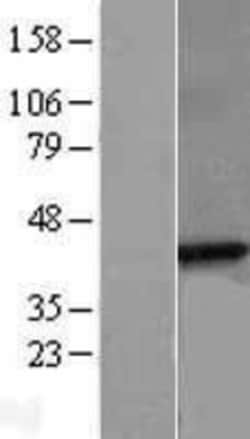 Novus Biologicals&trade;&nbsp;beta Sarcoglycan Overexpression Lysate
