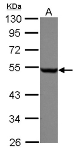 beta Tubulin Antibody, Novus Biologicals 0.1mL; Unlabeled:Antibodies, Polyclonal