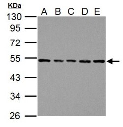 beta Tubulin Antibody, Novus Biologicals 0.1mL; Unlabeled:Antibodies, Polyclonal