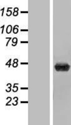 Novus Biologicals™ beta ureidopropionase Overexpression Lysate