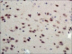 beta-1,3-Glucuronyltransferase 1/B3GAT1 Antibody - BSA Free, Novus Biologicals