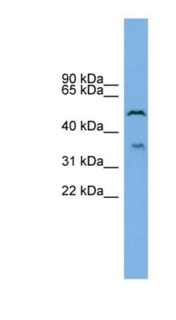 beta-1,3-Glucuronyltransferase 3/B3GAT3 Antibody, Novus Biologicals:Antibodies:Primary