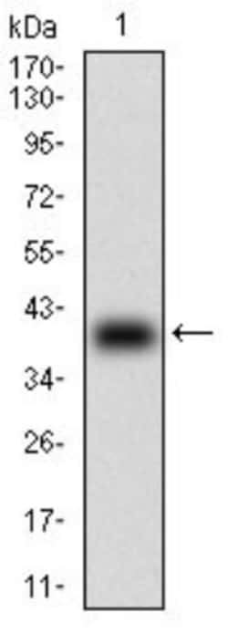 beta 2-Microglobulin Antibody (3G5H8) - BSA Free, Novus Biologicals:Antibodies:Primary