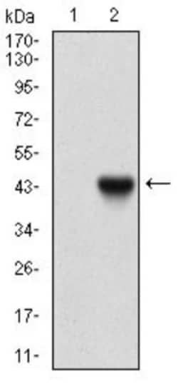 beta 2-Microglobulin Antibody (4G5A1) - BSA Free, Novus Biologicals 0.1mL;