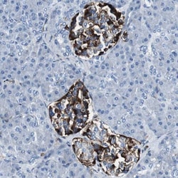 beta 2-Microglobulin Antibody, Novus Biologicals 25 &mu;L | Buy Online | Novus Biologicals | Fisher Scientific