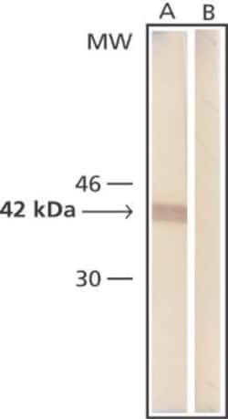 beta-Actin Antibody (AC-15), Novus Biologicals 0.1mL; Unlabeled:Antibodies,
