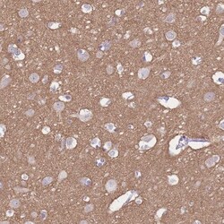 beta Adducin Antibody, Novus Biologicals:Antibodies:Primary Antibodies