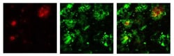 beta Amyloid, Pyro Glu11 Antibody, Novus Biologicals 0.05mg; Unlabeled:Antibodies,