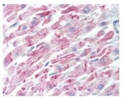 beta Amyloid Antibody, Novus Biologicals 0.1mg; Unlabeled:Antibodies, Polyclonal