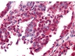 beta Amyloid Antibody, Novus Biologicals 0.1mg; Unlabeled:Antibodies, Polyclonal