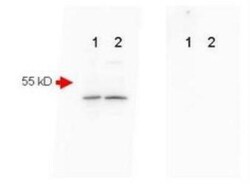 beta Amyloid Antibody, Novus Biologicals 0.1mg; Unlabeled:Antibodies, Polyclonal