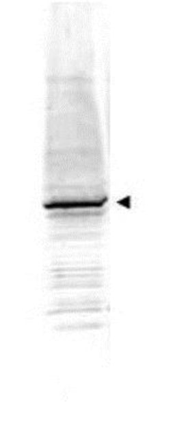 beta Amyloid Antibody, Novus Biologicals 0.1mg; Unlabeled:Antibodies, Polyclonal