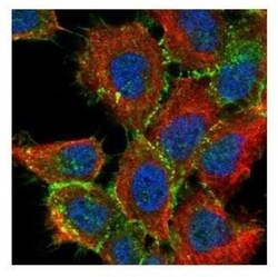 beta-Catenin Antibody, Novus Biologicals 0.1mg; Unlabeled:Antibodies, Polyclonal